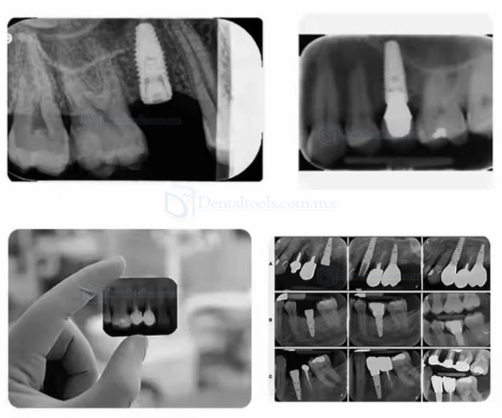 Mecco MC Ray V M&aacute;quina de rayos X port&aacute;til para radiograf&iacute;a dental